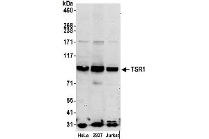 Western Blotting (WB) image for anti-TSR1, 20S rRNA Accumulation, Homolog (TSR1) (AA 25-75) antibody (ABIN7449849)
