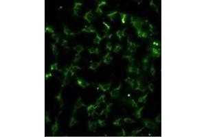 Immunofluorescence analysis of CA9 Antibody (Center) with hela cells. (CA9 Antikörper  (AA 113-143))