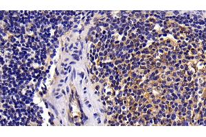 Immunohistochemistry (IHC) image for anti-Caspase 8 (CASP8) (AA 7-201) antibody (ABIN7444115)