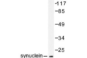Image no. 1 for anti-Synuclein, alpha (SNCA) antibody (ABIN271837) (SNCA Antikörper)