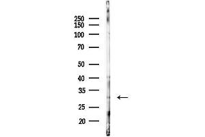 anti-Ribosomal Protein S6 Kinase Related (RSKR) antibody