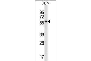 MOSPD2 Antibody (N-term ) (ABIN657246 and ABIN2846344) western blot analysis in CEM cell line lysates (35 μg/lane). (MOSPD2 Antikörper  (N-Term))