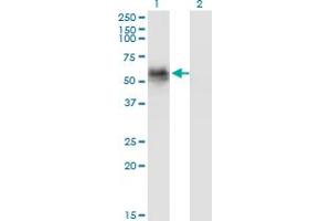 Western Blotting (WB) image for anti-Cyclin G Associated Kinase (GAK) (AA 151-250) antibody (ABIN560986)