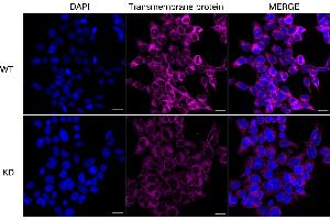 Immunocytochemical staining of HeLa cells using transmembrane protein 43 antibody (ABIN7800622), 1:1,000), Top panel: wild-type (WT), Bottom panal: Transmembrane protein 43 shRNA knockdown (KD).