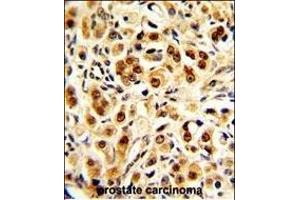 Immunohistochemistry (Paraffin-embedded Sections) (IHC (p)) image for anti-Glyceraldehyde-3-Phosphate Dehydrogenase (GAPDH) (AA 233-259), (C-Term) antibody (ABIN392354)