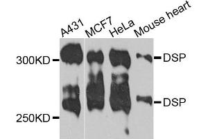 Western blot analysis of extracts of various cells, using DSP antibody.