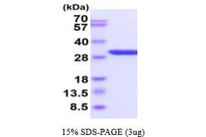 SDS-PAGE (SDS) image for Galectin 3 (LGALS3) (AA 1-250) protein (His tag) (ABIN666905) (Galectin 3 Protein (LGALS3) (AA 1-250) (His tag))