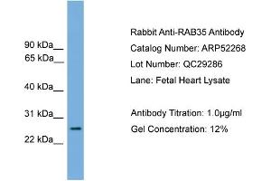 WB Suggested Anti-RAB35  Antibody Titration: 0. (RAB35 Antikörper  (Middle Region))