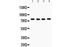 Western Blotting (WB) image for anti-Protein Kinase C, alpha (PKCa) (AA 153-342) antibody (ABIN3043549)