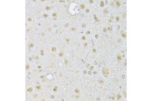 Immunohistochemistry of paraffin-embedded rat brain using HDAC3 Antibody (ABIN1872955) at dilution of 1:100 (40x lens).