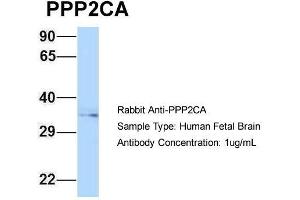 Host: Rabbit  Target Name: PPP2CA  Sample Tissue: Human Fetal Brain  Antibody Dilution: 1. (PPP2CA Antikörper  (N-Term))