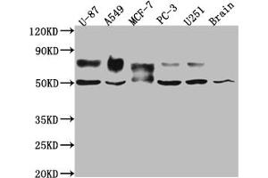 Western Blot Positive WB detected in: U-87 whole cell lysate, A549 whole cell lysate, MCF-7 whole cell lysate, PC-3 whole cell lysate, U-251 whole cell lysate, Mouse Brain whole cell lysate All lanes: 5T4 antibody at 1:1000 Secondary Goat polyclonal to rabbit IgG at 1/50000 dilution Predicted band size: 47 kDa Observed band size: 50, 80 kDa (Rekombinanter TPBG Antikörper)
