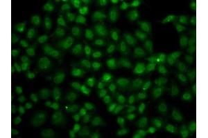 Immunofluorescence analysis of A549 cells using USP26 antibody. (USP26 Antikörper  (AA 664-913))