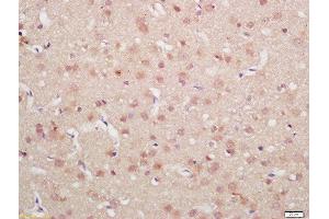Formalin-fixed and paraffin embedded rat brain labeled with Rabbit Anti-MDM2(Ser186) Polyclonal Antibody, Unconjugated  at 1:200 followed by conjugation to the secondary antibody and DAB staining (MDM2 Antikörper  (pSer186))