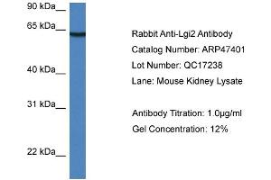 Western Blotting (WB) image for anti-Leucine-Rich Repeat LGI Family, Member 2 (LGI2) (Middle Region) antibody (ABIN2782947) (LGI2 Antikörper  (Middle Region))