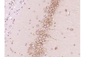 Immunohistochemistry (Paraffin-embedded Sections) (IHC (p)) image for anti-Protein tyrosine Phosphatase, Non-Receptor Type 5 (Striatum-Enriched) (PTPN5) (AA 201-300) antibody (ABIN1385743)