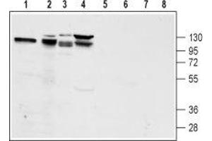 Western blot analysis of rat pancreas lysate (lanes 1 and 5), mouse preadipocyte 3T3-L1 lysate (lanes 2 and 6), rat pancreatic islet cell line RIN-5F lysate (lanes 3 and 7) and human pancreatic carcinoma PANC-1 lysate (lanes 4 and 8): - 1-4. (GLP1R Antikörper  (2nd Extracellular Loop))