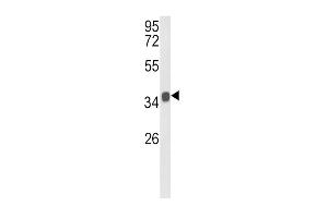 Western blot analysis of KLF6 Antibody in mouse stomach tissue lysates (35ug/lane) (KLF6 Antikörper  (C-Term))