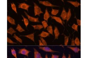 Immunofluorescence analysis of L929 cells using KIF13A Polyclonal Antibody at dilution of 1:100.