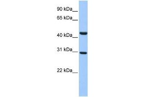 WB Suggested Anti-TULP3 Antibody Titration:  0. (TULP3 Antikörper  (Middle Region))
