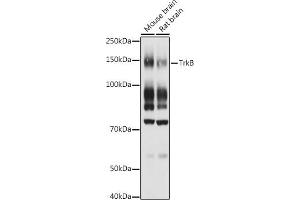 Western blot analysis of extracts of various cell lines, using TrkB antibody (ABIN3022911, ABIN3022912, ABIN3022913 and ABIN6219292) at 1:1000 dilution. (TRKB Antikörper  (AA 32-282))
