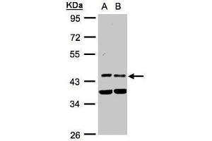 WB Image Sample(30 ug whole cell lysate) A:HeLa S3, B:MOLT4 , 10% SDS PAGE antibody diluted at 1:1000 (PDK1 Antikörper)