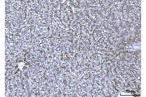 IHC analysis of GLUD1/2 using anti-GLUD1/2 antibody (ABIN7602000). (GLUD1 / GLUD2 (AA 54-553) Antikörper)