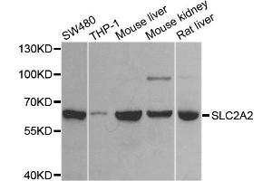 Western blot analysis of extracts of various cell lines, using SLC2A2 antibody. (SLC2A2 Antikörper)