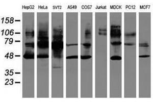 Image no. 2 for anti-serpin Peptidase Inhibitor, Clade B (Ovalbumin), Member 1 (SERPINB1) (AA 77-306) antibody (ABIN1491672) (SERPINB1 Antikörper  (AA 77-306))