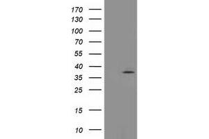 Western Blotting (WB) image for anti-Translocase of Outer Mitochondrial Membrane 34 (TOMM34) antibody (ABIN1501469)
