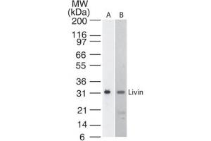 Livin BIRC7 KIAP Western Blot. (BIRC7 Antikörper)