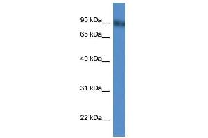 Western Blot showing Pde4d antibody used at a concentration of 1-2 ug/ml to detect its target protein. (PDE4D Antikörper  (N-Term))