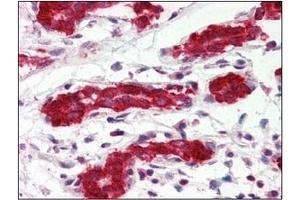Immunohistochemistry (IHC) image for anti-Programmed Cell Death 4 (PDCD4) (AA 1-469), (N-Term) antibody (ABIN317548) (PDCD4 Antikörper  (N-Term))