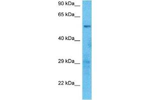 Host:  Rabbit  Target Name:  SLCO2B1  Sample Type:  U937 Whole Cell lysates  Antibody Dilution:  1.