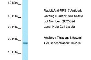 Western Blotting (WB) image for anti-Ribosomal Protein S17 (RPS17) (Middle Region) antibody (ABIN2789845) (RPS17 Antikörper  (Middle Region))