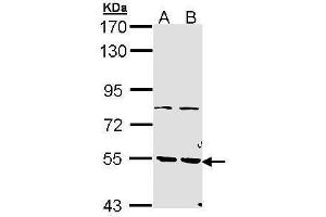 WB Image Sample (30 ug of whole cell lysate) A: H1299 B: Hela 7. (PDE1A Antikörper)