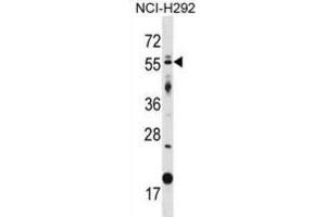 Western Blotting (WB) image for anti-GLIS Family Zinc Finger 2 (GLIS2) antibody (ABIN2998792) (GLIS2 Antikörper)