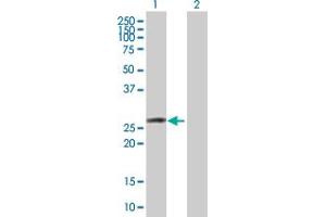 Western Blot analysis of OSTF1 expression in transfected 293T cell line by OSTF1 MaxPab polyclonal antibody. (OSTF1 Antikörper  (AA 1-217))