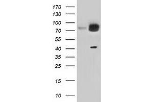 Western Blotting (WB) image for anti-Kelch Repeat and BTB (POZ) Domain Containing 7 (KBTBD7) antibody (ABIN1498995) (KBTBD7 Antikörper)