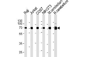 ACHE Antibody (C-term) (ABIN1882203 and ABIN2838474) western blot analysis in Raji,Jurkat,COS7,mouse NIH/3T3 cell line and mouse cerebellum,rat cerebellum tissue lysates (35 μg/lane). (Acetylcholinesterase Antikörper  (C-Term))