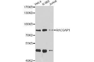 Western blot analysis of extracts of various cell lines, using RACGAP1 antibody (ABIN5973044) at 1/1000 dilution. (RACGAP1 Antikörper)