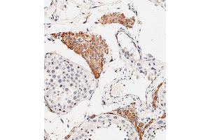Immunohistochemical analysis of paraffin-embedded human testis tissue using C performed on the Leica® BOND RXm. (OTUD3 Antikörper  (AA 192-220))