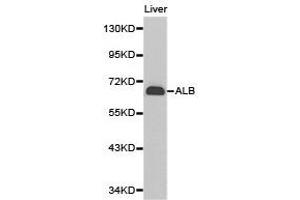Western Blotting (WB) image for anti-Albumin (ALB) antibody (ABIN2650895)