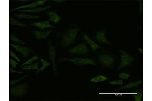 Immunofluorescence of monoclonal antibody to GRK4 on HeLa cell. (GRK4 Antikörper  (AA 36-145))