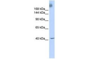 Image no. 1 for anti-TAF1 RNA Polymerase II, TATA Box Binding Protein (TBP)-Associated Factor, 250kDa (TAF1) (AA 1800-1849) antibody (ABIN6740301) (TAF1 Antikörper  (AA 1800-1849))