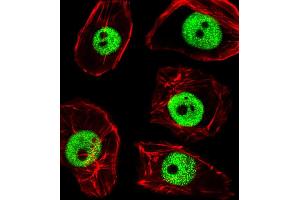 Fluorescent image of MDA-M cells stained with TPD52L3 Antibody (N-term) A. (TPD52L3 Antikörper  (N-Term))