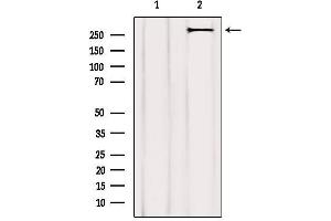 Western Blotting (WB) image for anti-Acetyl-CoA Carboxylase alpha (ACACA) (N-Term) antibody (ABIN6259721)
