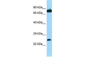 Host: Rabbit Target Name: SNX27 Sample Type: Jurkat Whole Cell lysates Antibody Dilution: 1. (SNX27 Antikörper  (C-Term))
