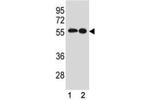 Src antibody western blot analysis in (1) MCF-7 and (2) A431 lysate (Src Antikörper  (AA 24-52))