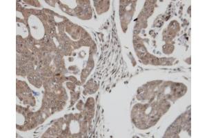 Immunohistochemistry (IHC) image for anti-Thioredoxin Reductase 1 (TXNRD1) antibody (ABIN2855577)